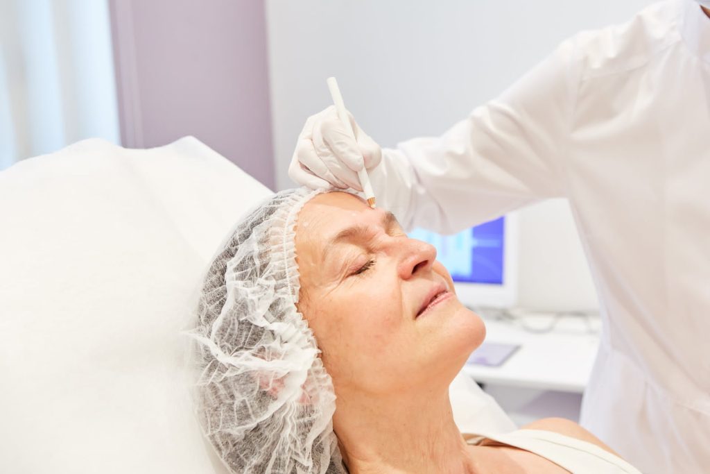 Clinician performing an Erbium laser epidermal resurfacing treatment to reduce fine wrinkles on a patient's forehead.