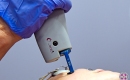 thumbs_laser-vein-removal-pulsed-dye-laser