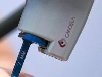 acne-rosacea-treatment-on-face