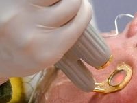 acne-rosacea-treatment