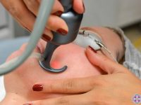 close-up-of-co2-fractional-laser-cheek-ama-regenerative-medicine-skincare