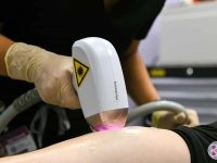 diode-laser-hair-removal-ama-regen-med-skincare-copy