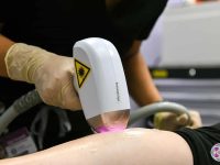 diode-laser-hair-removal-ama-regen-med-skincare-copy