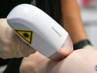 diode-laser-hair-removal-orange-county-ama-skincare-2