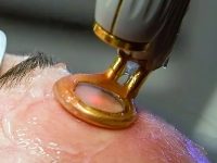 facial-redness-treatment