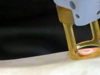 hair-laser-treatment-copy