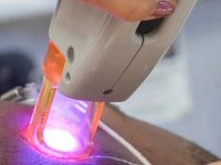 hair-removal-for-men-copy