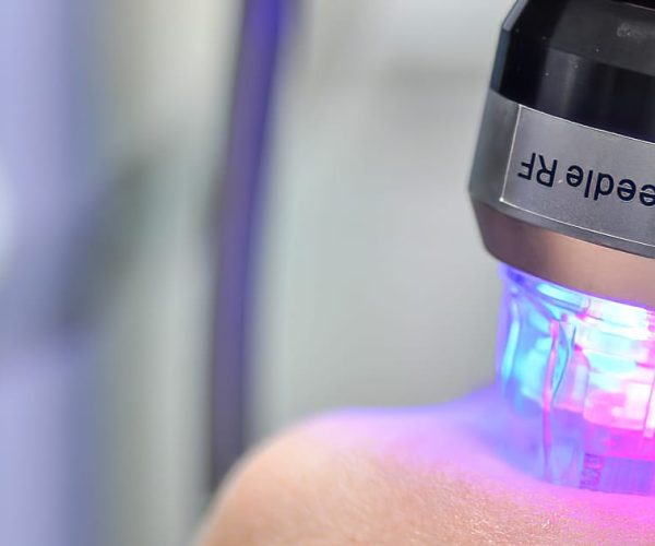 header-rf-microneedling-final