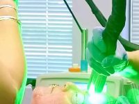 ktp-laser-tretment-for-rosacea