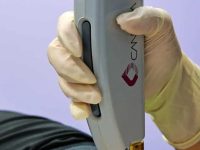 laser-hair-removal-copy