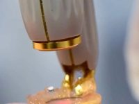 laser-rosacea-treatment-on-chin