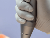 laser-tattoo-removal-stomach