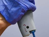 laser-treatment-for-reosacea-on-face