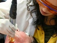 laser-vein-removal
