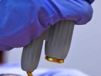 laser-vein-removal-with-ktp-laser