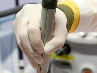 laser-vein-removal-with-yag-laser