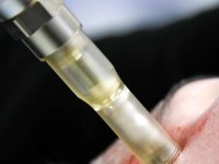 microneedling-face 1