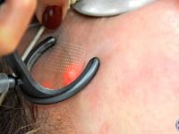 regenerative-medicine-and-skincare