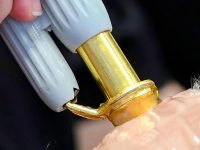spider-vein-removal-with-yag-laser