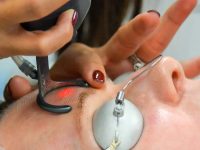 vertopal.com_starting-the-co2-fractional-laser-procedure-on-forehead-ama-regenerative-medicine-skincare